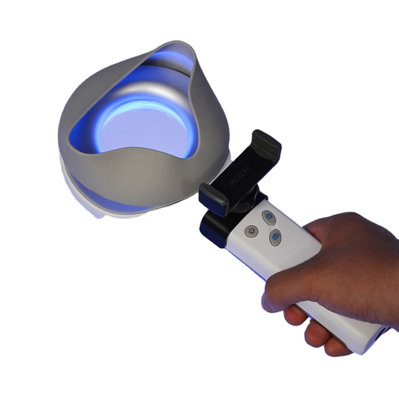 피부 질환 탈색 및 과색소침착 검사 및 진단용 Kern - Led Medical Headlight 리뷰 및 가격